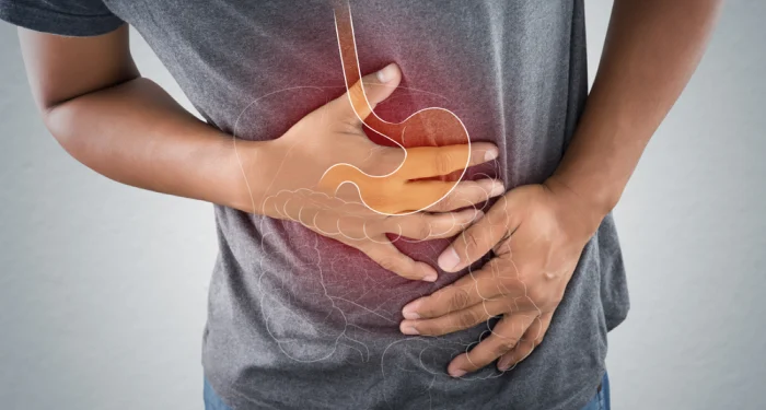 Peptic Stomach Ulcer Disease